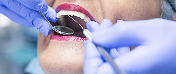 Best Knocked-Out Tooth (Avulsed Tooth) Treatment in Walce Ridge, LA